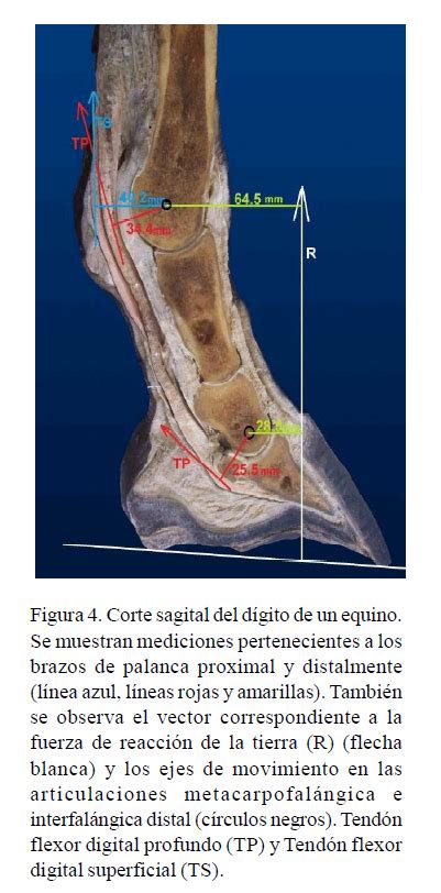 Diagrama esquemático del aparato suspensorio y tendones flexores en el dígito equino.