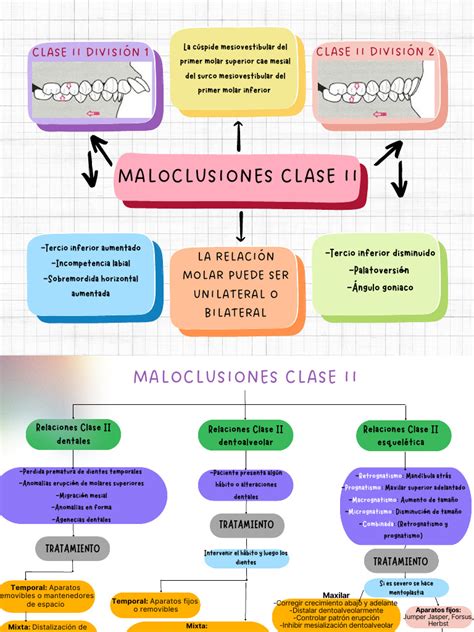 Esquema de las diferentes maloclusiones esqueléticas (Clase I, II, III)