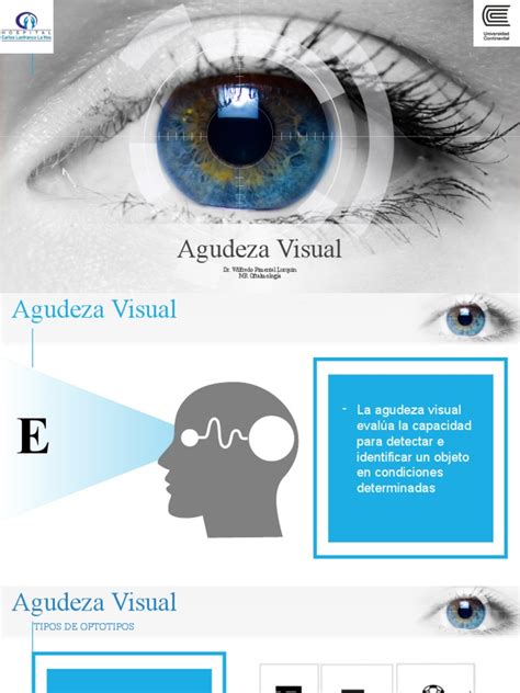 Tabla o diagrama explicando las categorías de agudeza visual y sus implicaciones