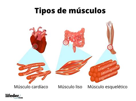 Diagrama: Comparación de músculos sanos y músculos con infiltración de grasa