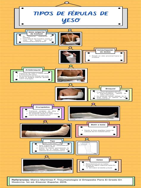 Infografía ilustrando los diferentes tipos de apoyos ortopédicos como muletas, férulas y andadores, con iconos de niños usándolos en actividades