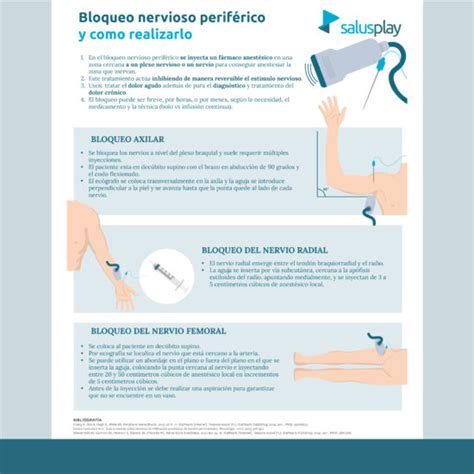 Infografía o esquema de un bloqueo nervioso ecoguiado