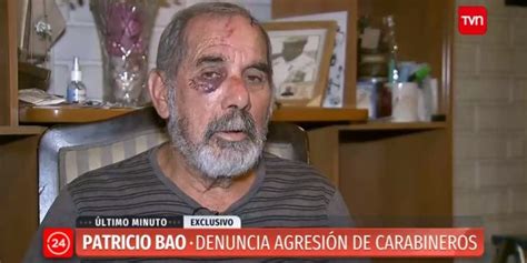 Foto de Patricio Bao, el adulto mayor agredido, con lesiones visibles en el rostro