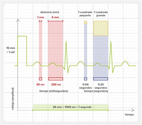 Gráfico que muestra la cuadrícula del papel de ECG con las medidas de tiempo y voltaje