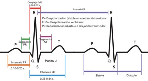 Diagrama de un ciclo cardíaco en ECG mostrando ondas P, QRS, T y sus intervalos