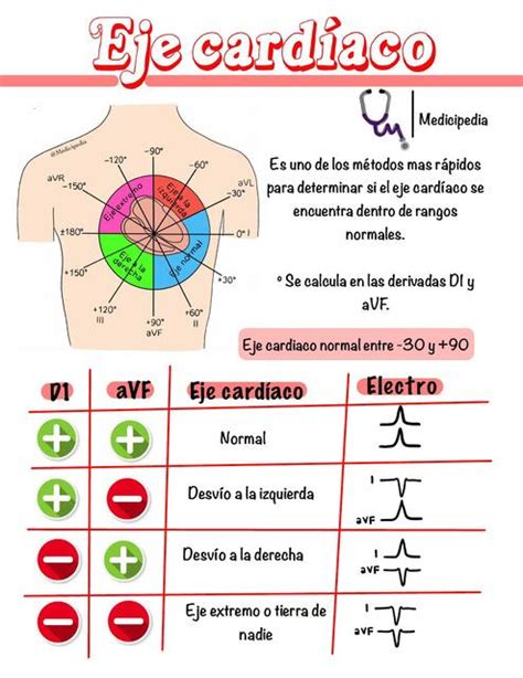 Esquema de los 4 cuadrantes del eje cardíaco y sus rangos