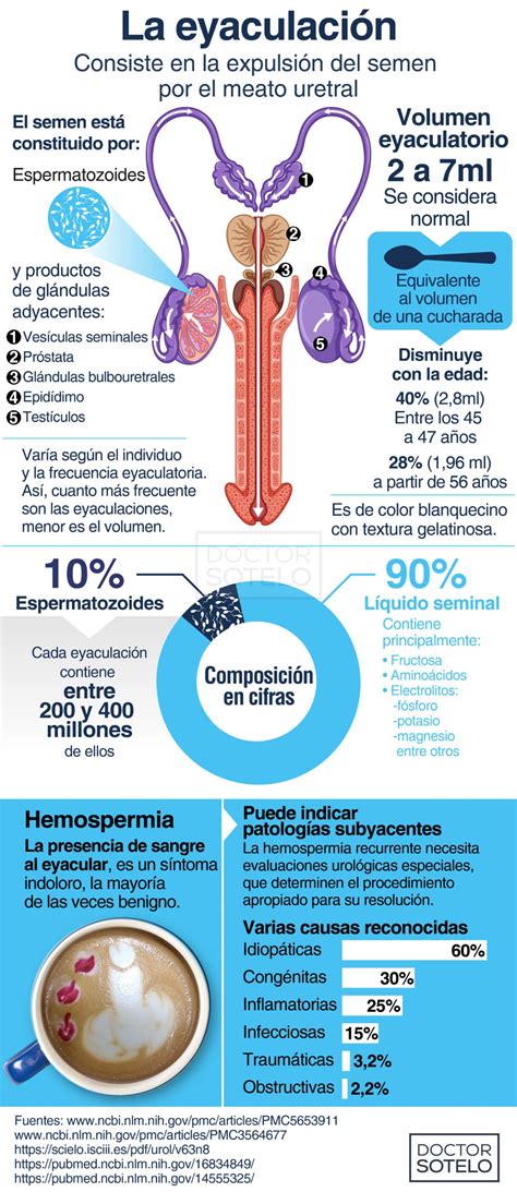 Esquema de los trastornos de la eyaculación masculina