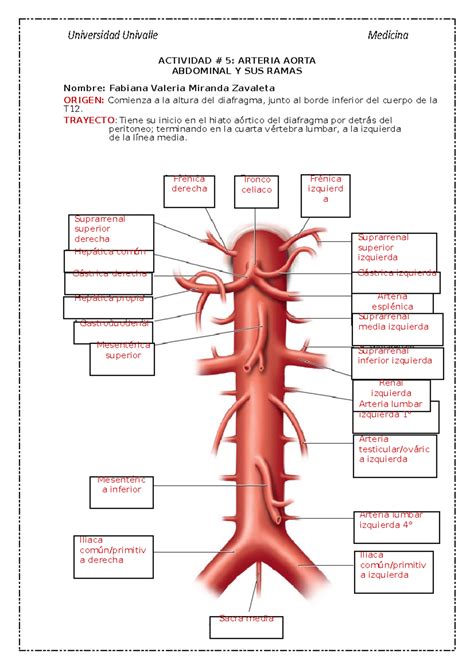 Esquema de la anatomía de la aorta abdominal y la localización de un aneurisma infrarrenal