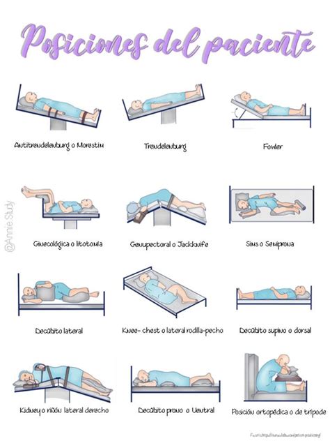 Ilustración de las diferentes posiciones del paciente para punción lumbar: decúbito lateral, sentado y decúbito prono