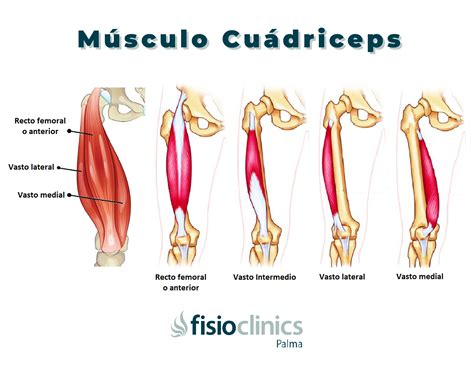Esquema de grupos musculares de las piernas (cuádriceps, isquiotibiales y glúteos) y su importancia en la movilidad diaria.