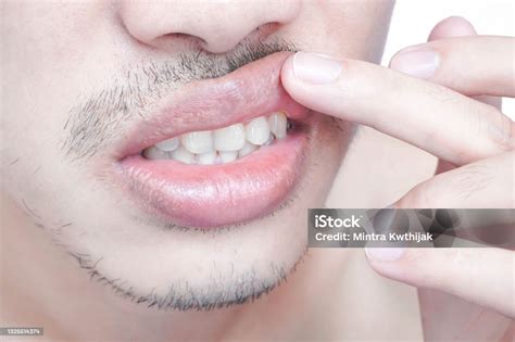 Foto de primeros planos de labios de personas mayores, mostrando signos de sequedad o agrietamiento