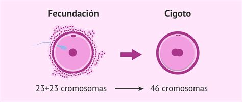 Esquema explicativo de la formación del cigoto con trisomía 18: unión de gametos con error en la segregación cromosómica.