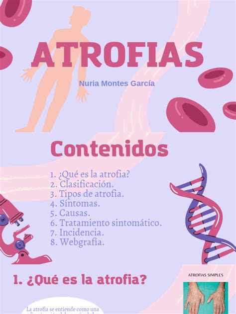 Infografía detallando los tipos de atrofia muscular y sus causas principales.