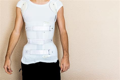 Foto de una persona usando un corsé ortopédico para escoliosis