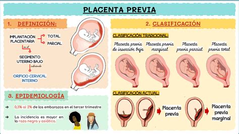 Diagrama de la posición normal de la placenta y los tipos de placenta previa