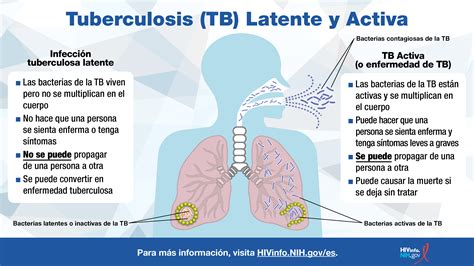 Infografía comparando la infección de TB latente y la enfermedad de TB activa con sus características y contagiosidad