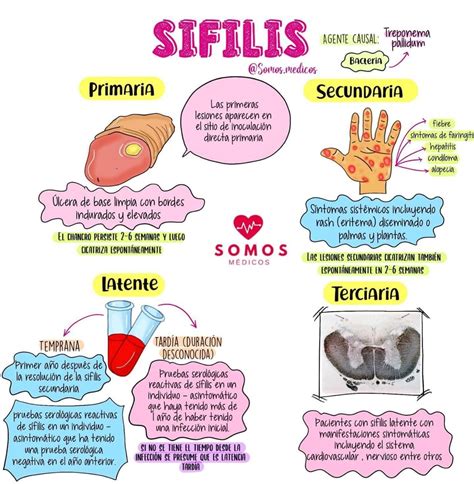 Esquema de las etapas de progresión de la sífilis en el cuerpo humano