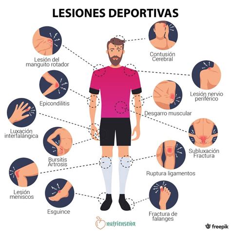 Diagrama: Partes del cuerpo más afectadas y tipos de lesiones comunes