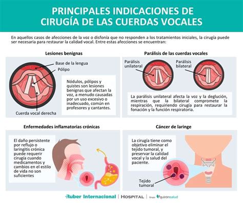 Gráfico comparativo de la longitud de las cuerdas vocales en diferentes etapas de la infancia.