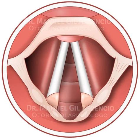 Microfotografía comparativa de la lámina propia de una cuerda vocal joven frente a una senescente.