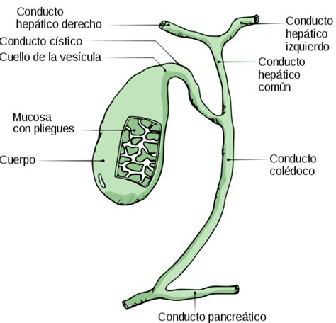 Esquema de la vesícula biliar con indicación del conducto cístico y la obstrucción por un cálculo biliar, causando inflamación.