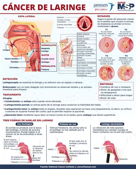Infografía: Cambios en la laringe con la edad
