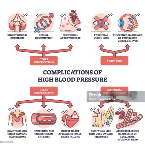 Esquema de las posibles complicaciones post-quirúrgicas de la catarata